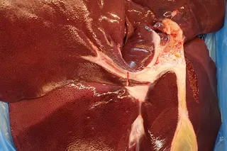 Wahlpflichtfach Biologie: Untersuchung einer Schweineleber